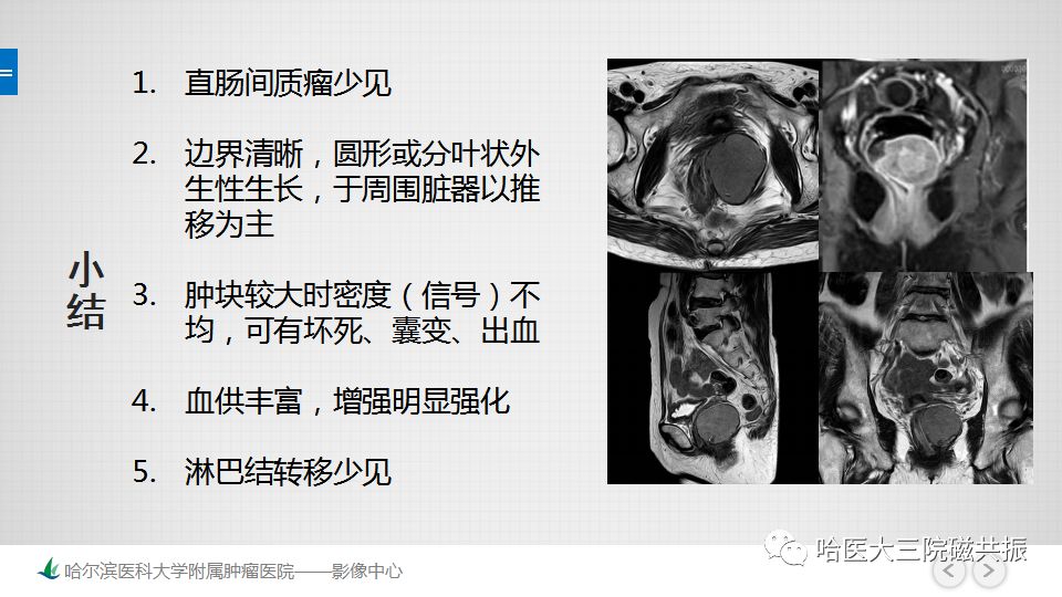 【PPT】胃肠道间质瘤—直肠病例讨论