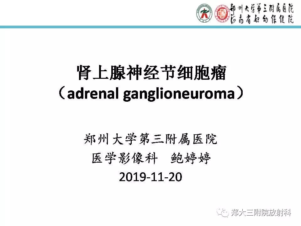 【PPT】肾上腺神经节细胞瘤