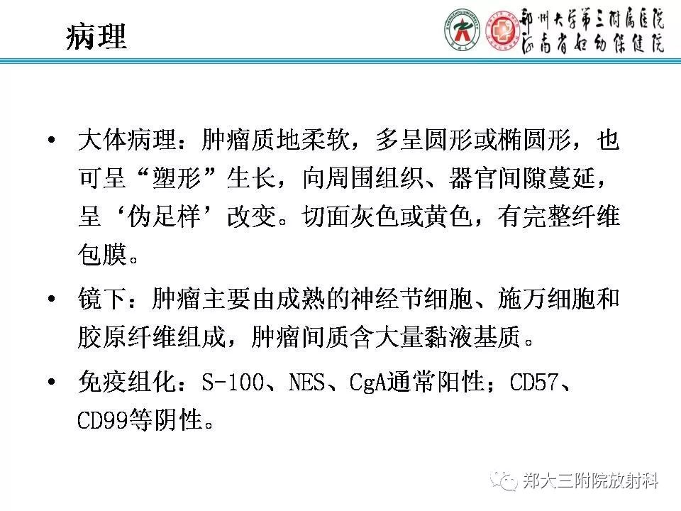 【PPT】肾上腺神经节细胞瘤