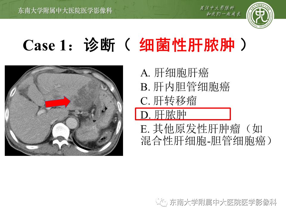 【PPT】肝占位性病变(3例)影像随访