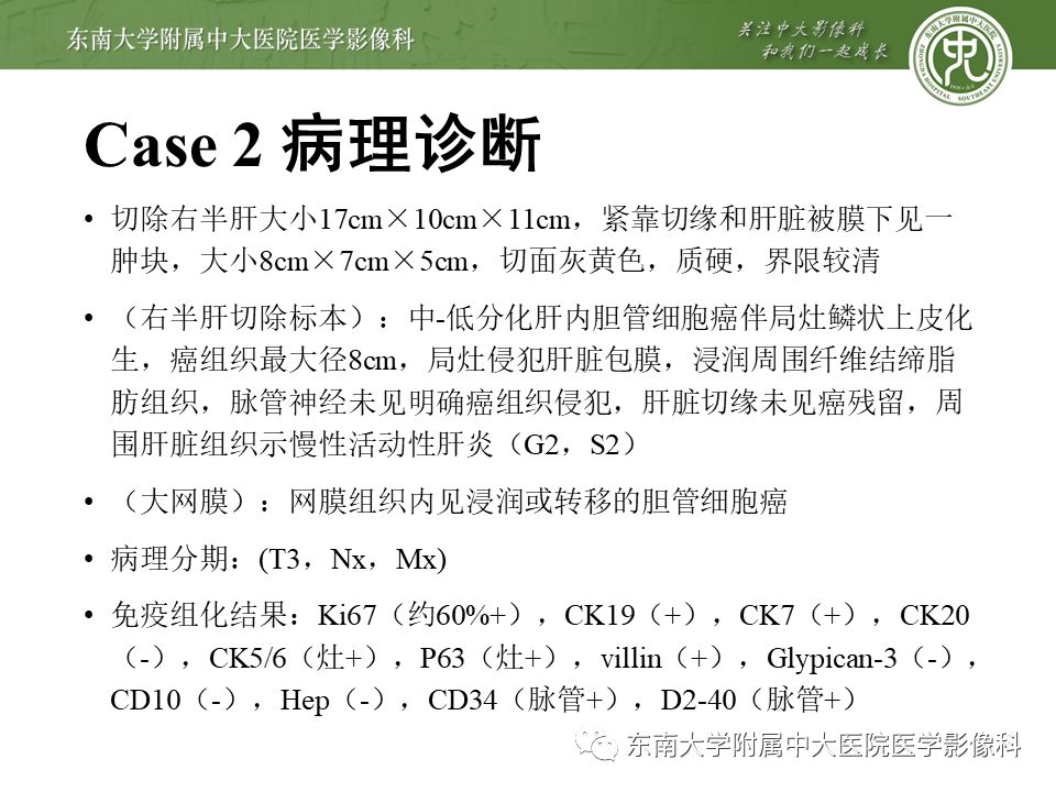 【PPT】肝占位性病变(3例)影像随访