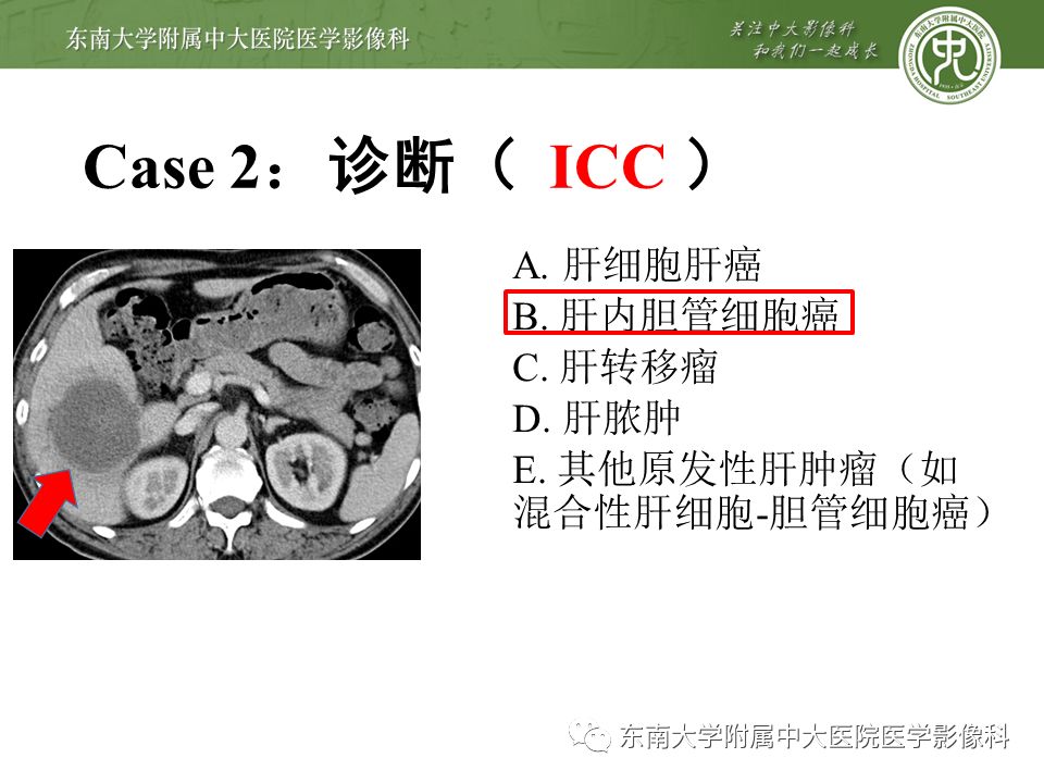 【PPT】肝占位性病变(3例)影像随访