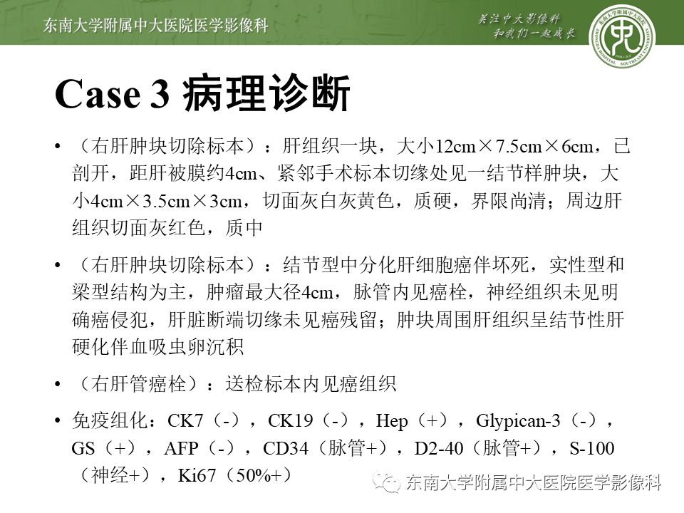 【PPT】肝占位性病变(3例)影像随访