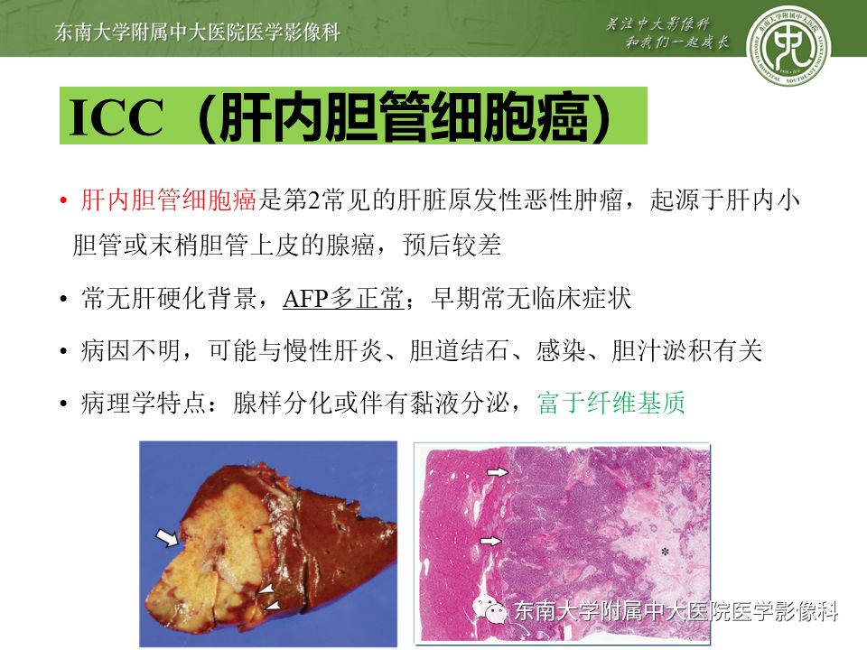 【PPT】肝占位性病变(3例)影像随访