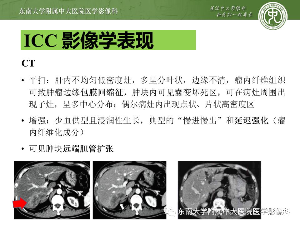 【PPT】肝占位性病变(3例)影像随访