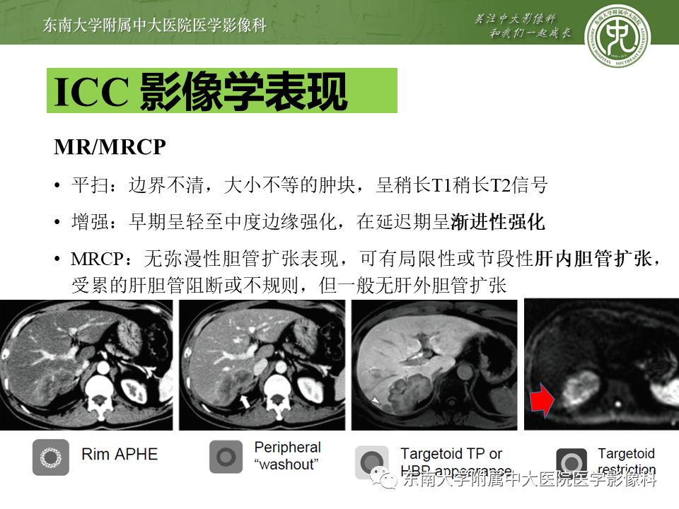 【PPT】肝占位性病变(3例)影像随访