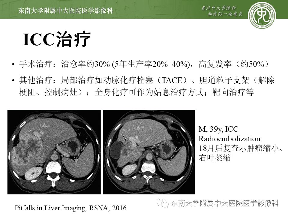【PPT】肝占位性病变(3例)影像随访