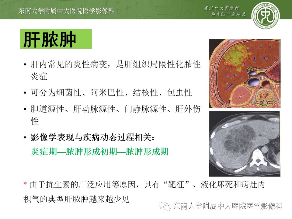 【PPT】肝占位性病变(3例)影像随访