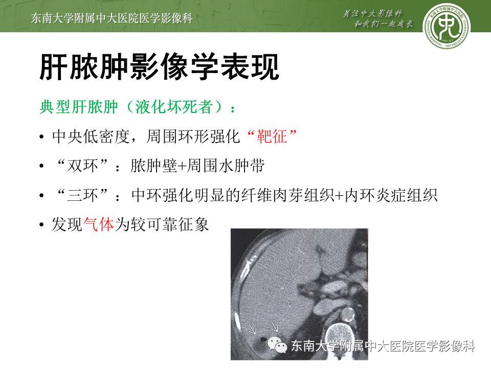 【PPT】肝占位性病变(3例)影像随访