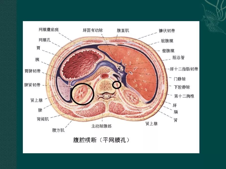 【PPT】胰腺假性囊肿