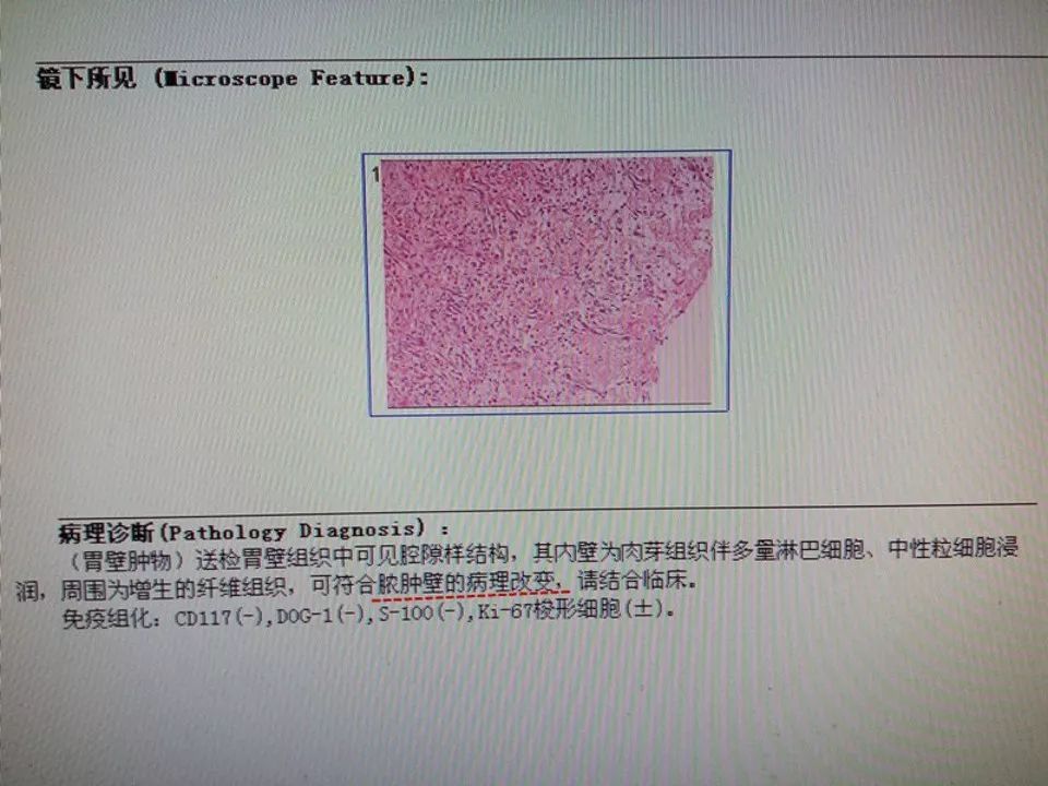 【PPT】胰腺假性囊肿
