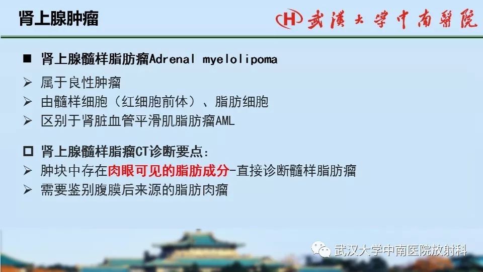 【PPT】肾上腺形态、功能及良恶性肿瘤CT影像诊断