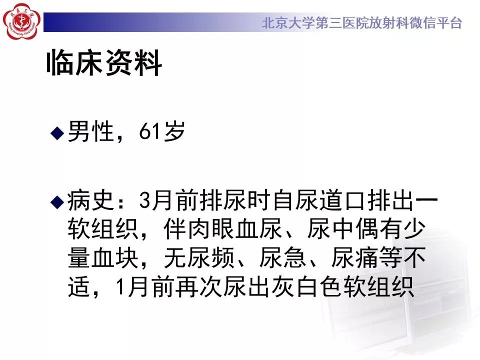 【病例】脐尿管癌1例CT影像