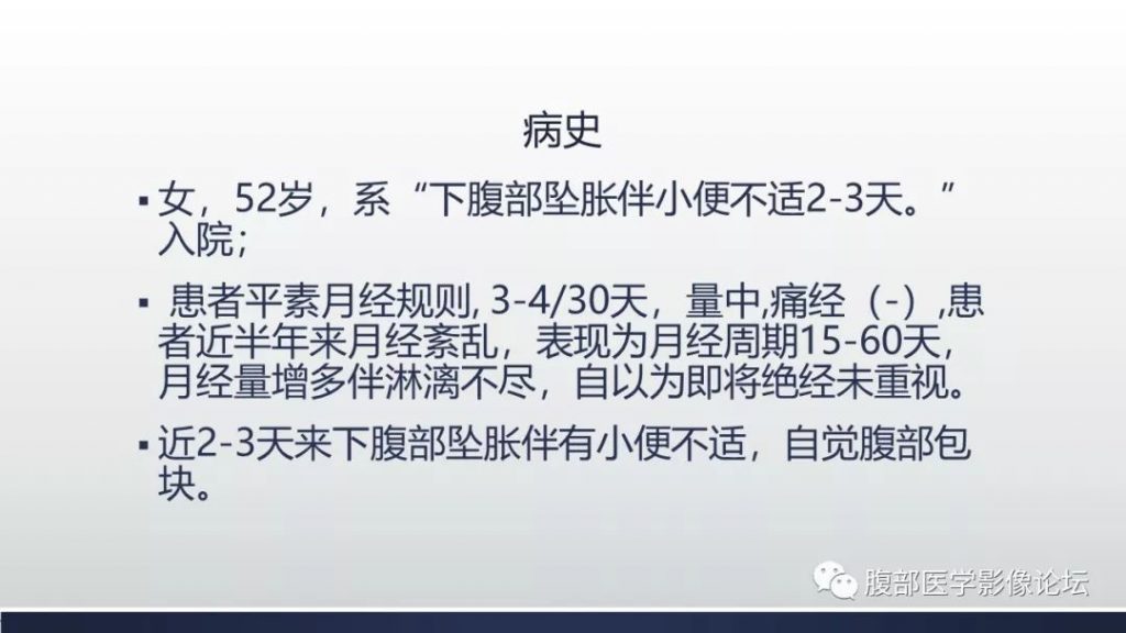 【病例】阔韧带平滑肌瘤1例MR影像