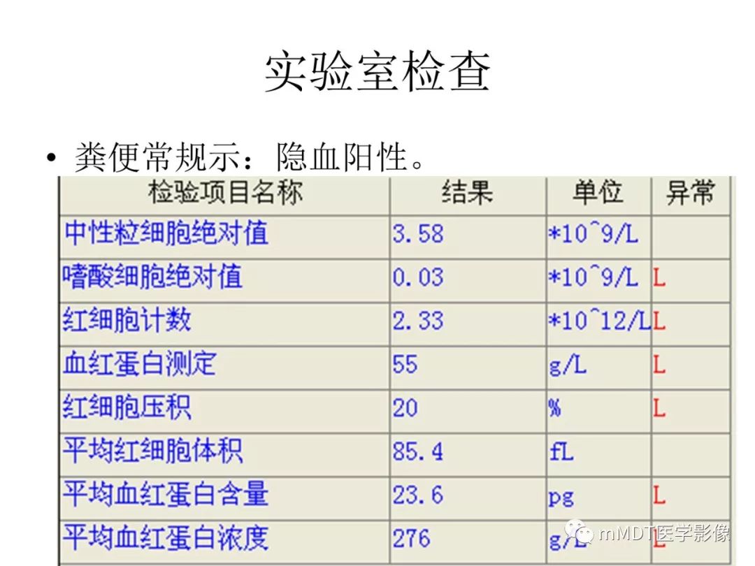 【病例】遗传性出血性毛细血管扩张症1例CT及MR影像
