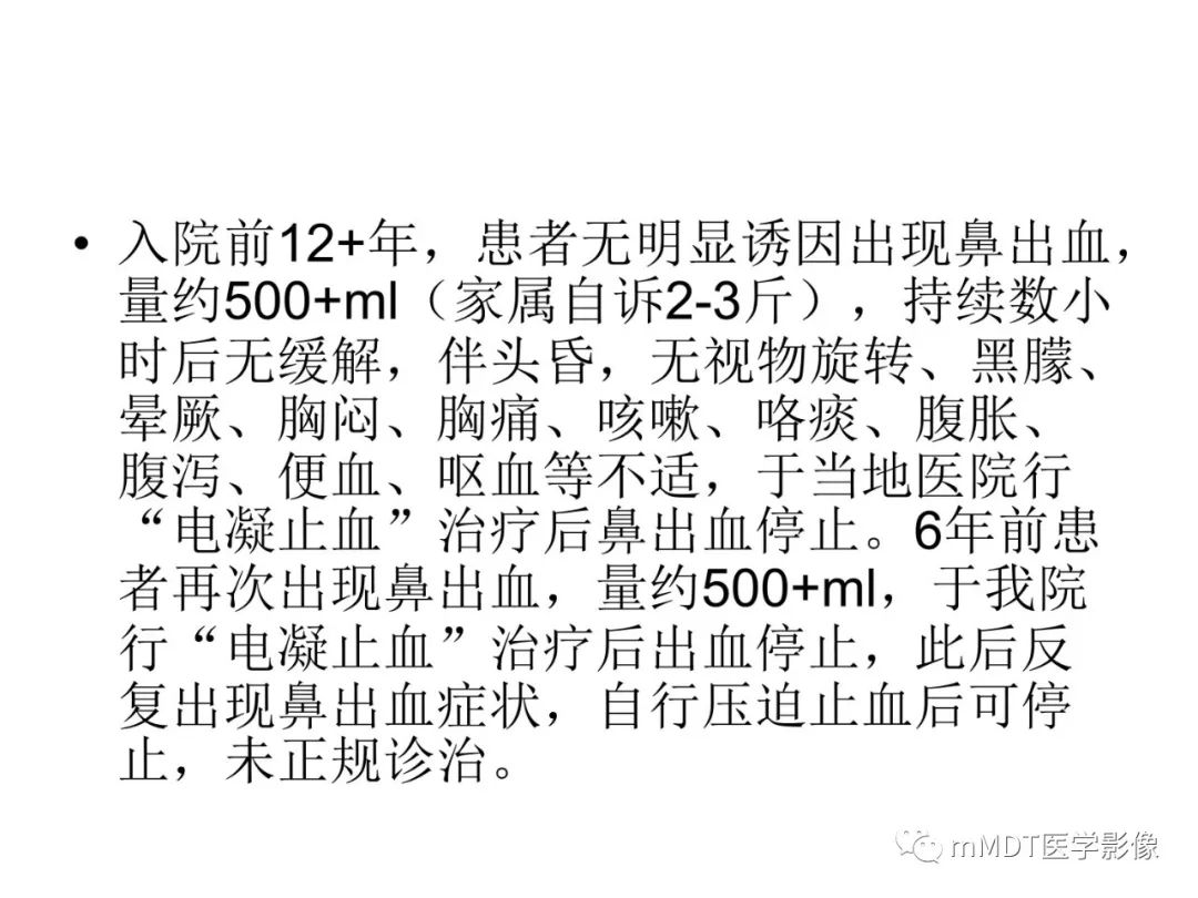 【病例】遗传性出血性毛细血管扩张症1例CT及MR影像