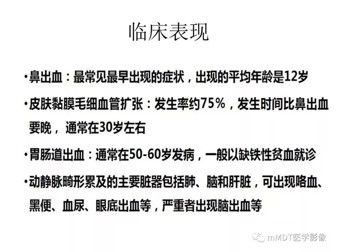 【病例】遗传性出血性毛细血管扩张症1例CT及MR影像