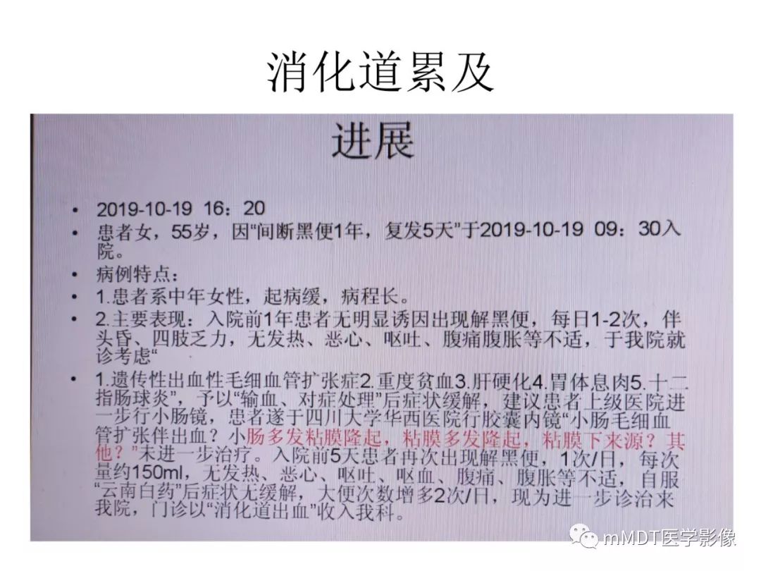 【病例】遗传性出血性毛细血管扩张症1例CT及MR影像