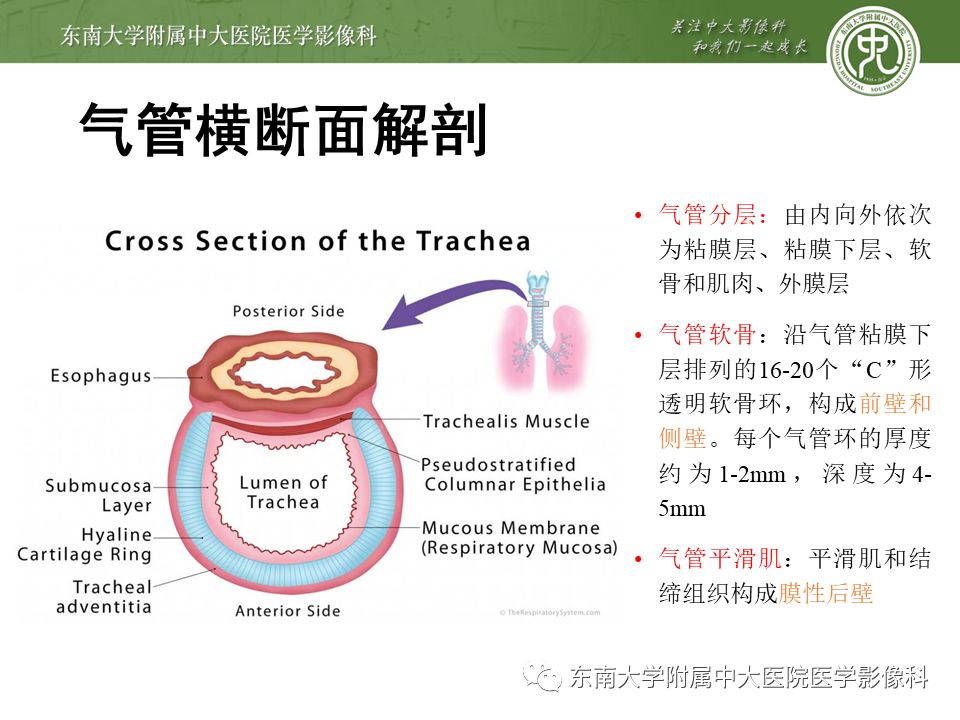 【病例】复发性多软骨炎1例CT影像