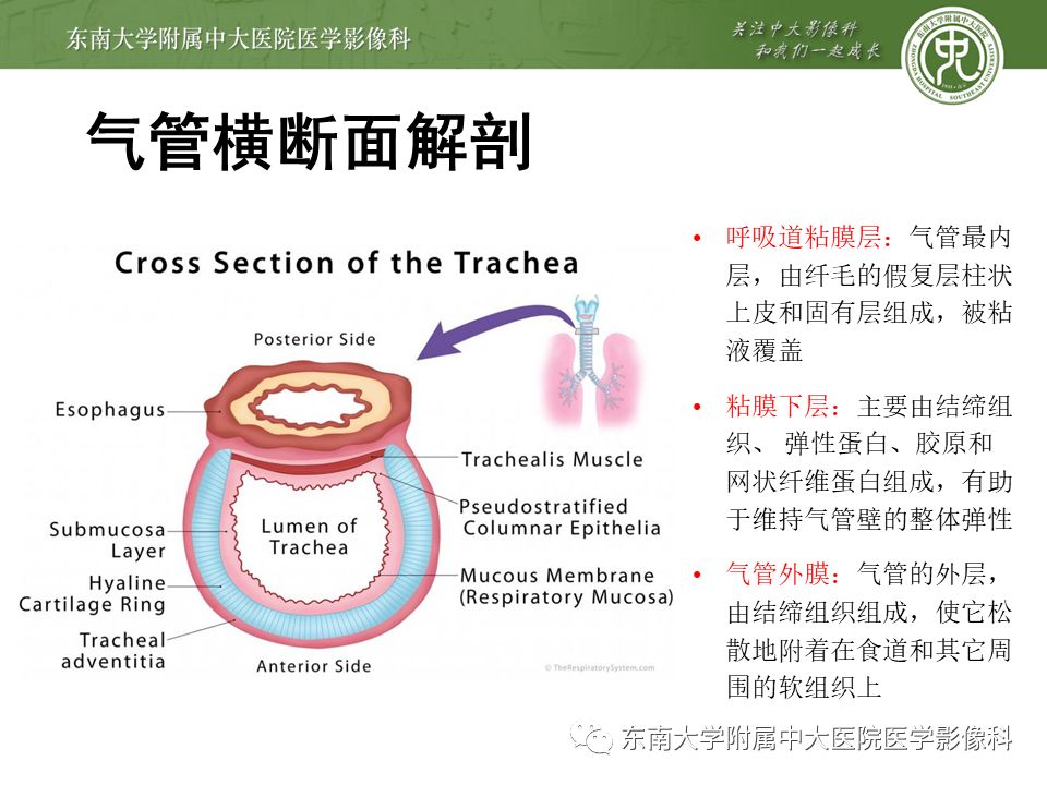 【病例】复发性多软骨炎1例CT影像