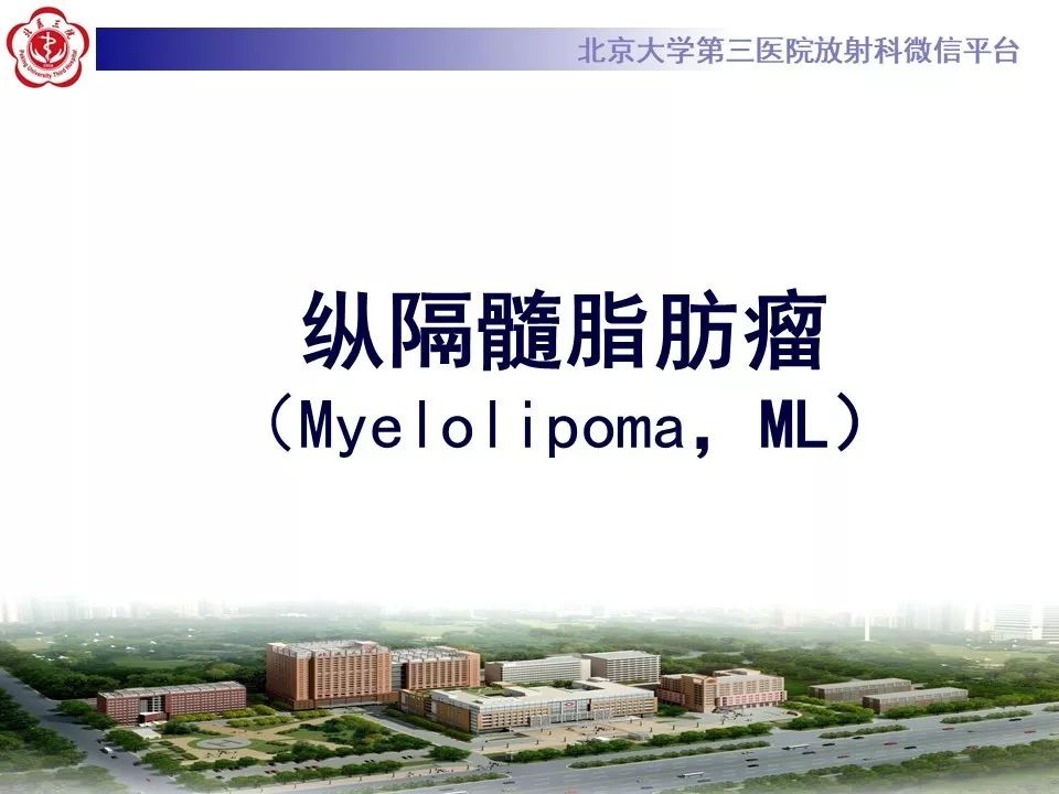【病例】纵隔髓脂肪瘤1例CT