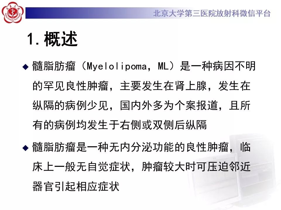 【病例】纵隔髓脂肪瘤1例CT