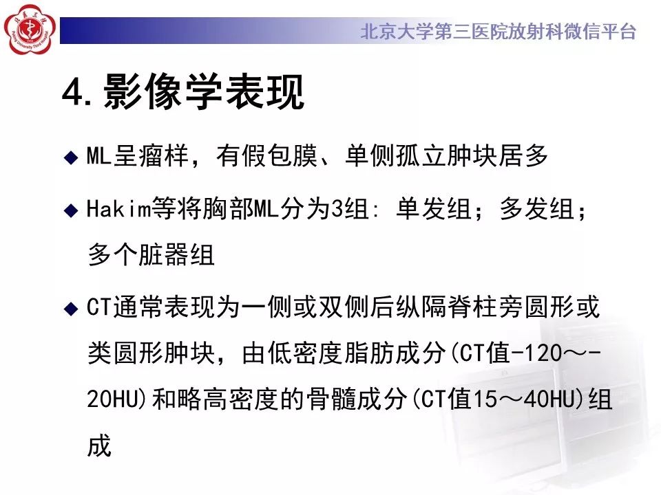【病例】纵隔髓脂肪瘤1例CT