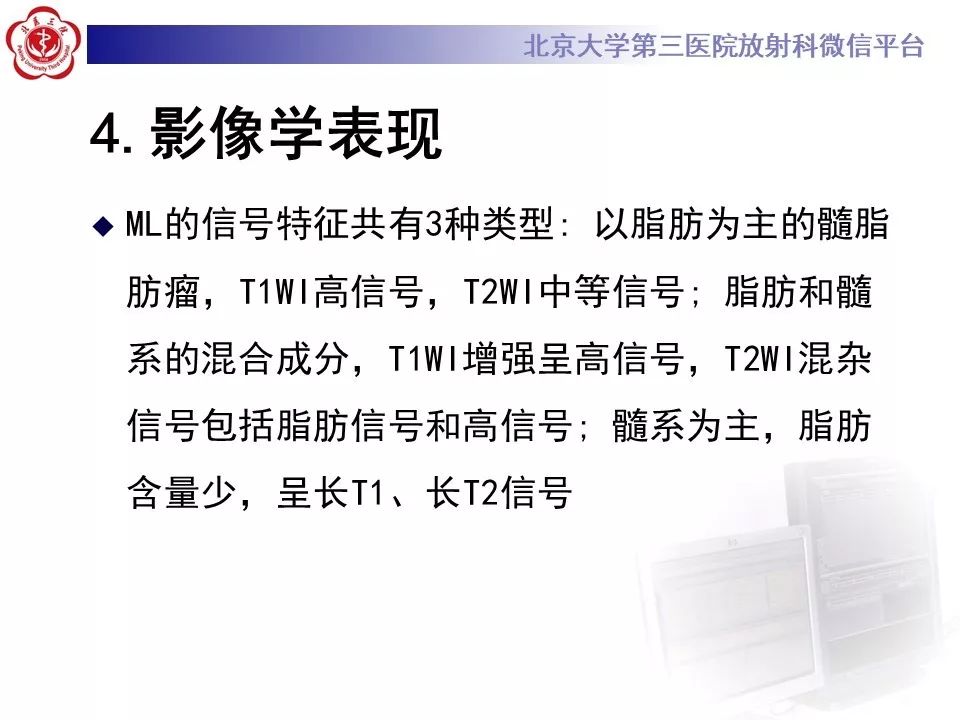 【病例】纵隔髓脂肪瘤1例CT