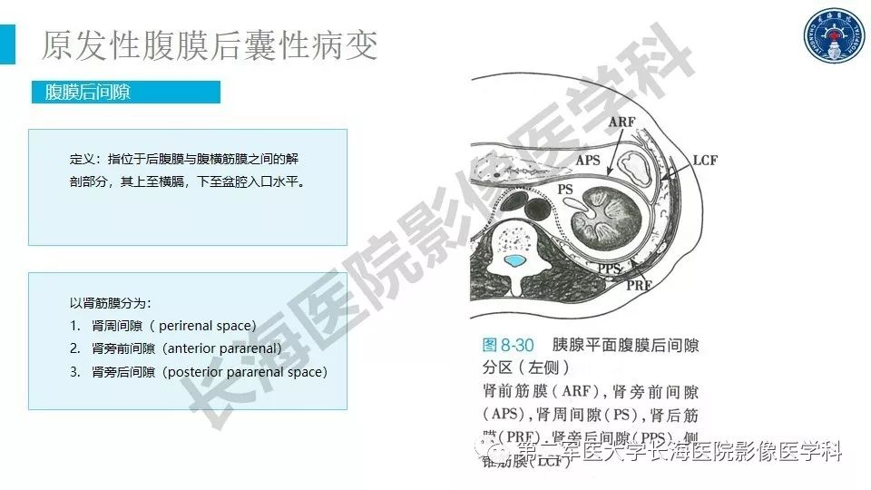 【PPT】原发性腹膜后囊性病变影像特征