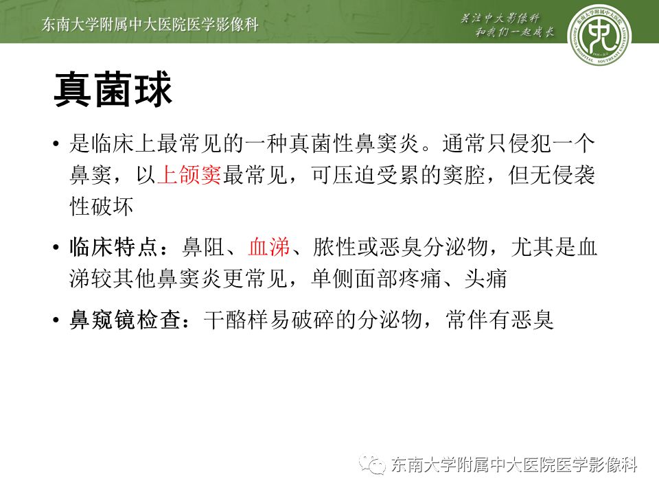 【病例】真菌性鼻窦炎1例CT影像