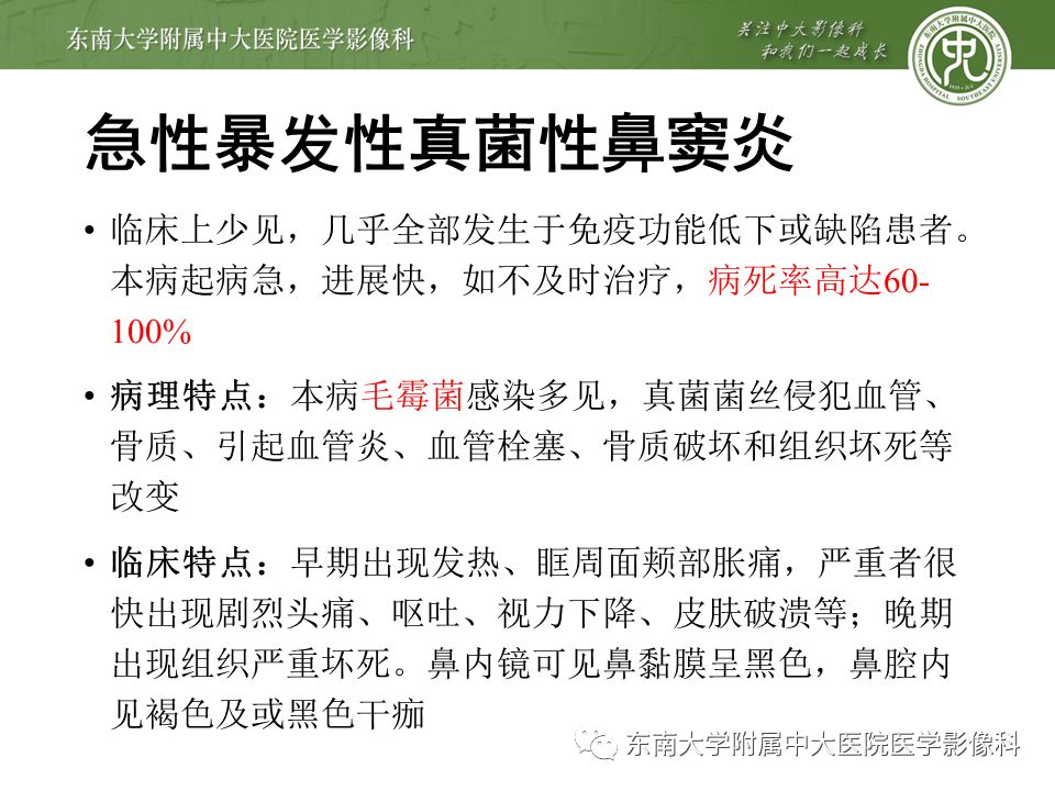 【病例】真菌性鼻窦炎1例CT影像