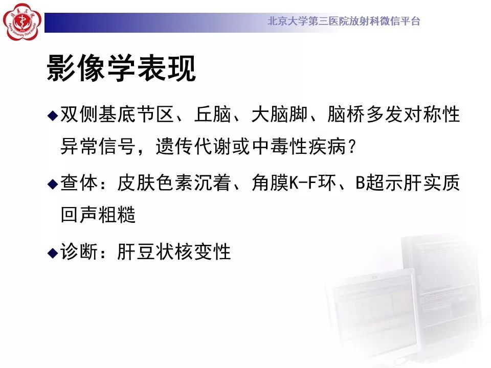 【病例】肝豆状核变性1例MR