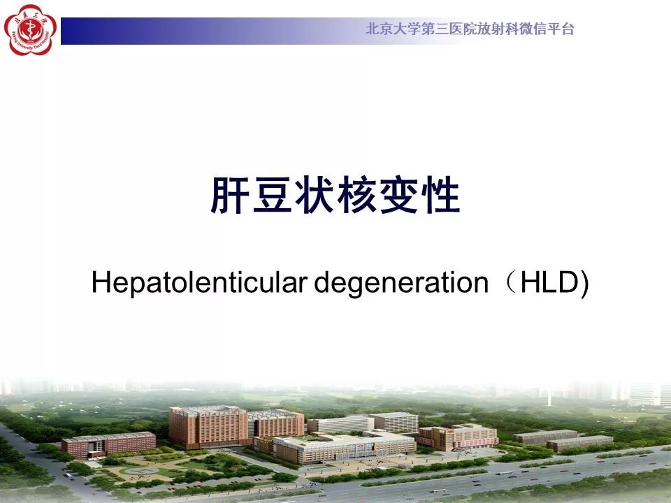 【病例】肝豆状核变性1例MR