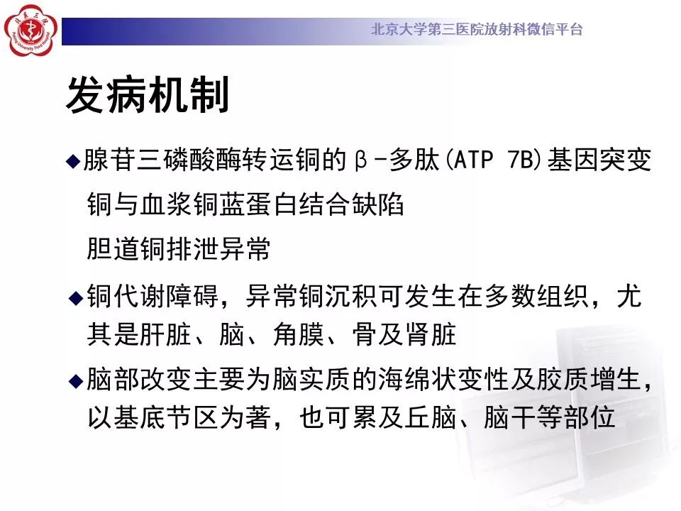 【病例】肝豆状核变性1例MR