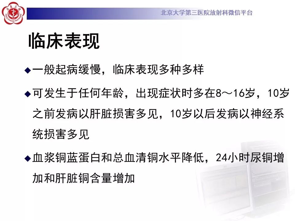 【病例】肝豆状核变性1例MR