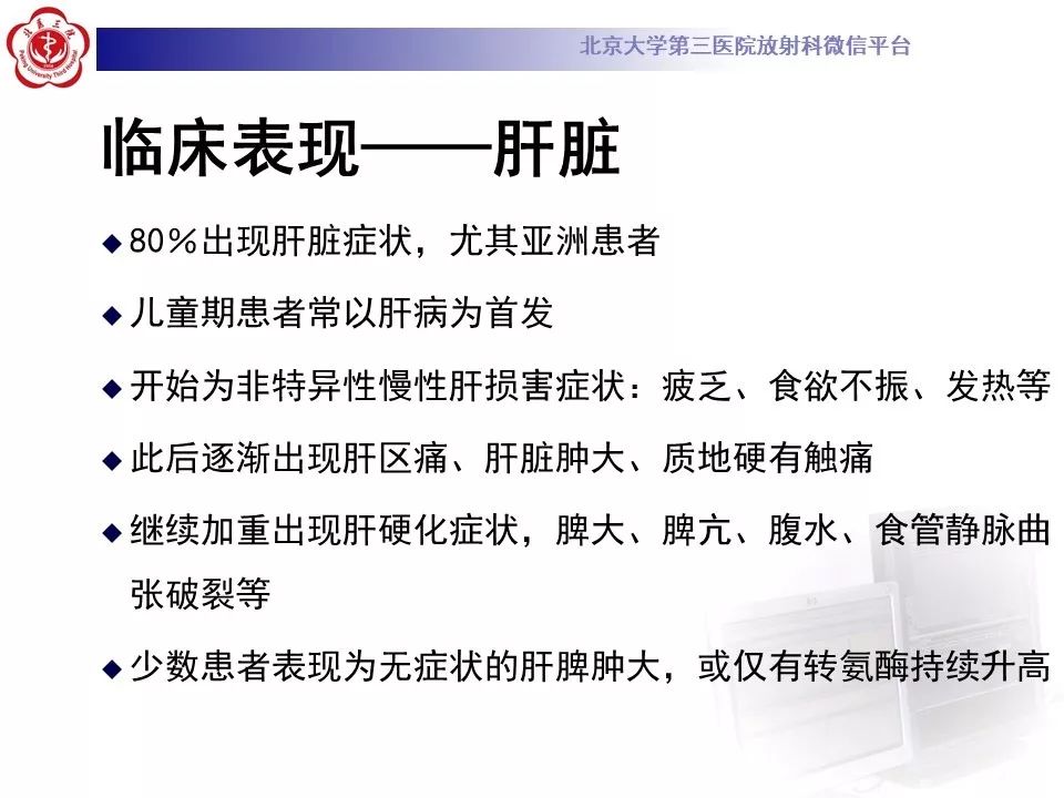 【病例】肝豆状核变性1例MR