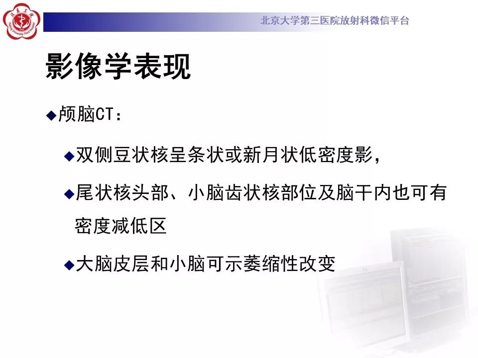 【病例】肝豆状核变性1例MR