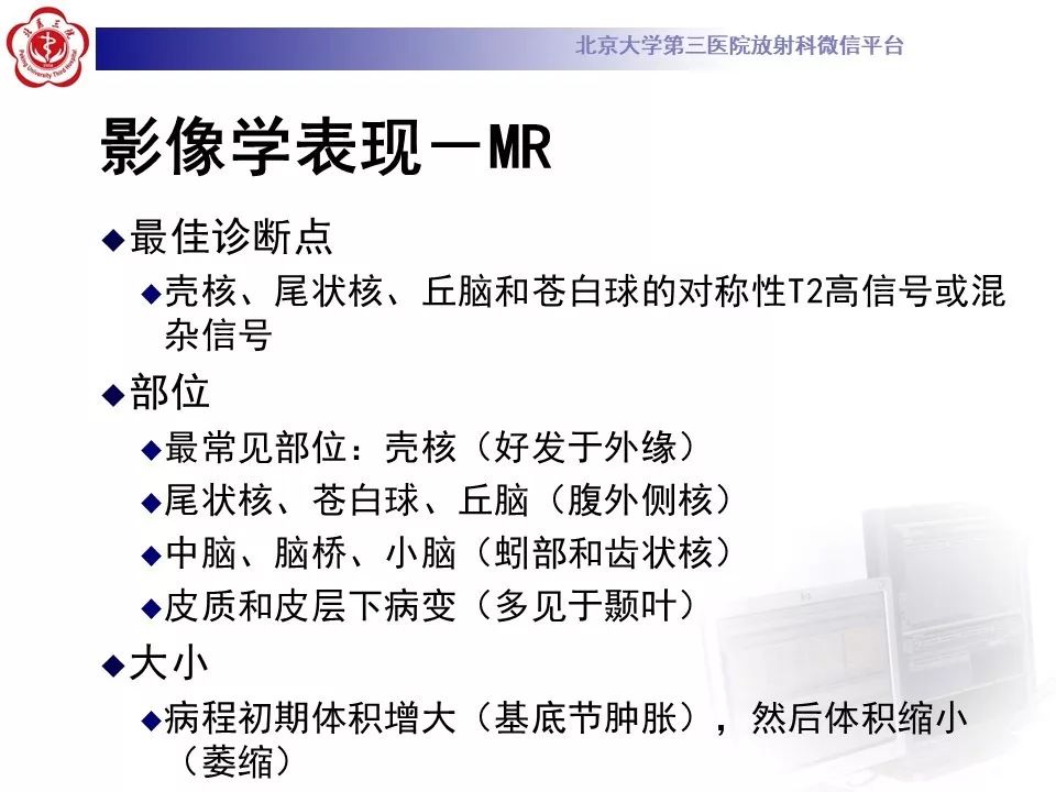 【病例】肝豆状核变性1例MR