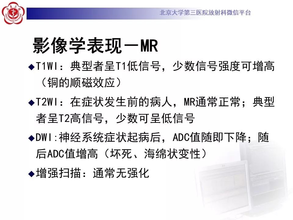 【病例】肝豆状核变性1例MR