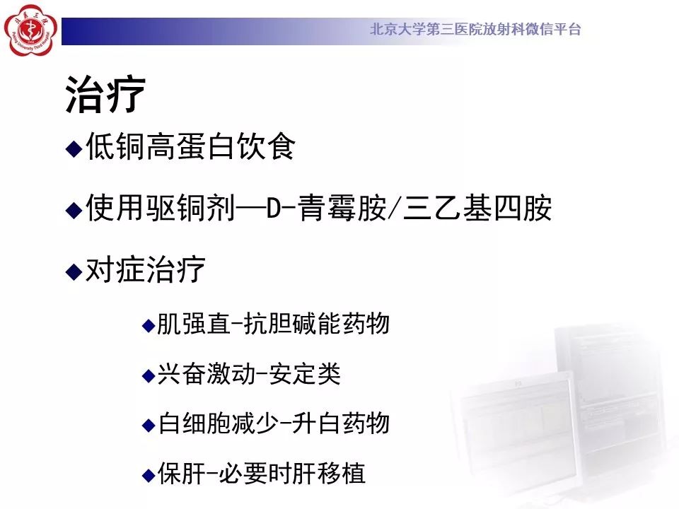 【病例】肝豆状核变性1例MR