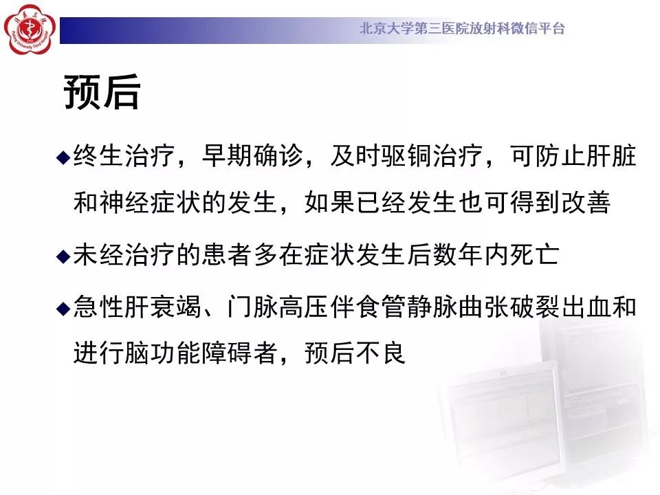 【病例】肝豆状核变性1例MR