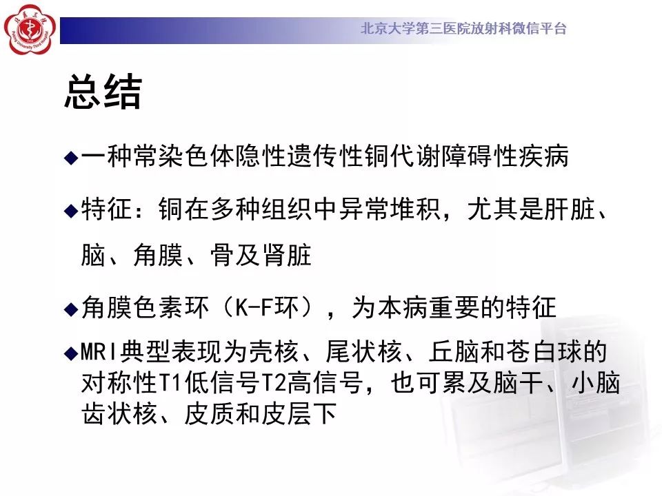 【病例】肝豆状核变性1例MR