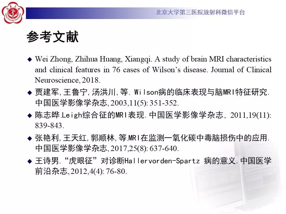 【病例】肝豆状核变性1例MR