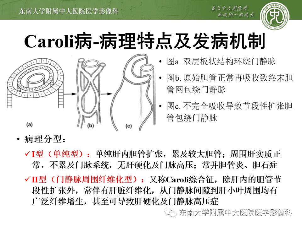 【病例】先天性肝囊性疾病2例CT影像