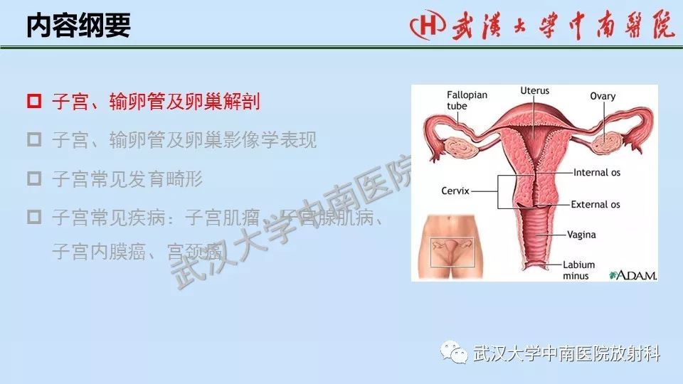 【PPT】女性生殖系统影像解剖及子宫常见疾病