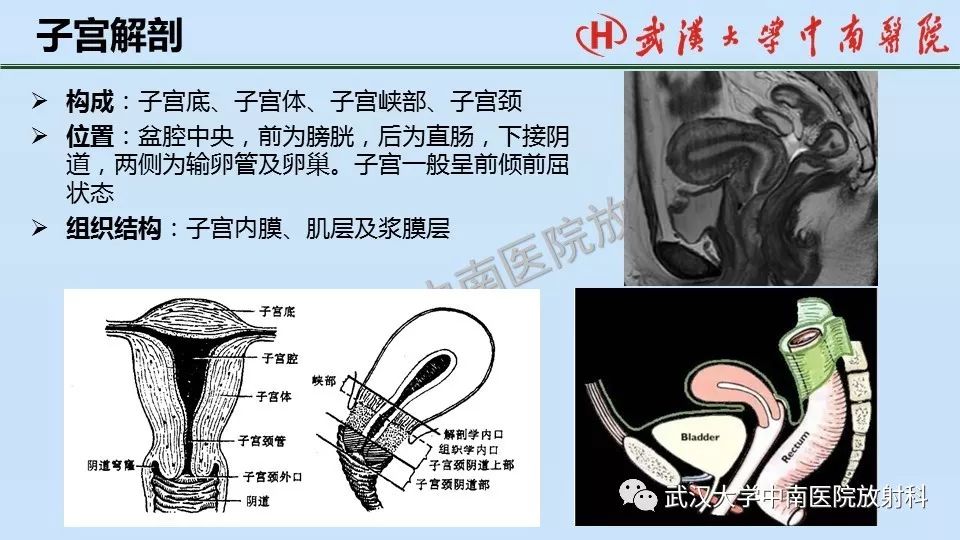 【PPT】女性生殖系统影像解剖及子宫常见疾病