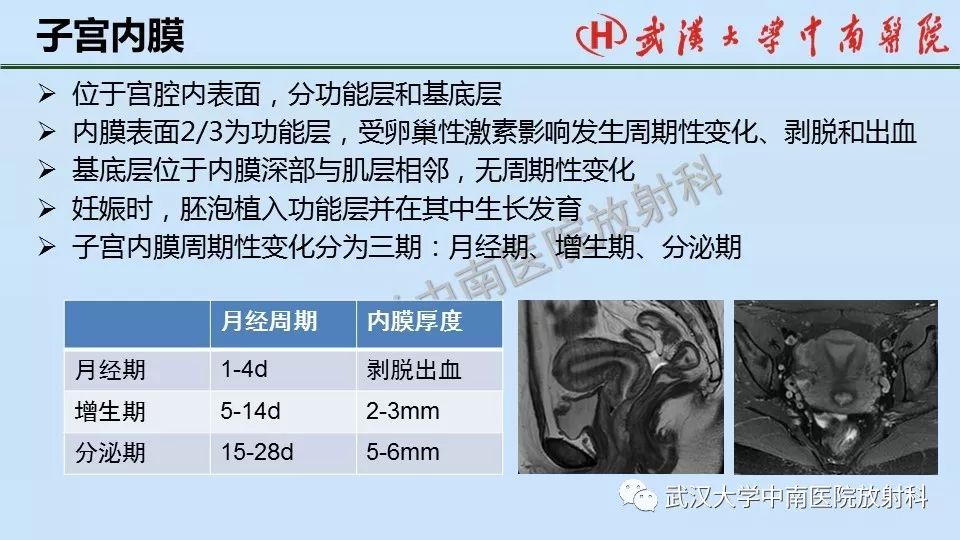 【PPT】女性生殖系统影像解剖及子宫常见疾病