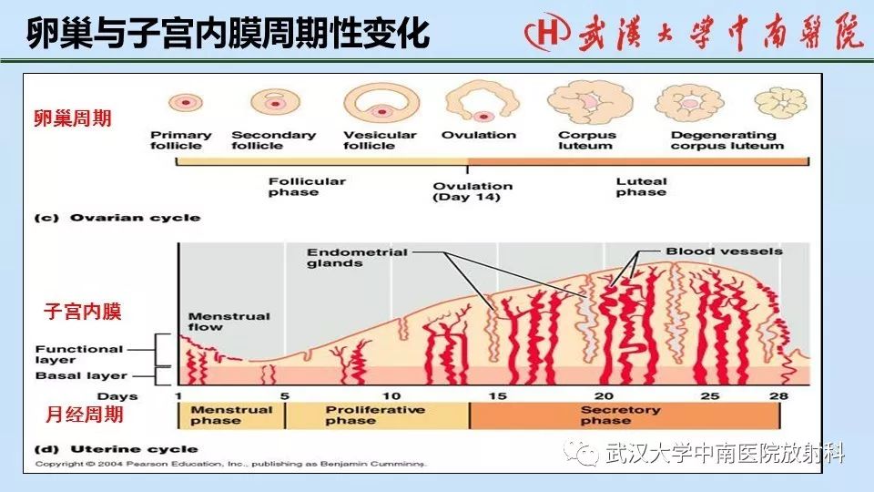 【PPT】女性生殖系统影像解剖及子宫常见疾病