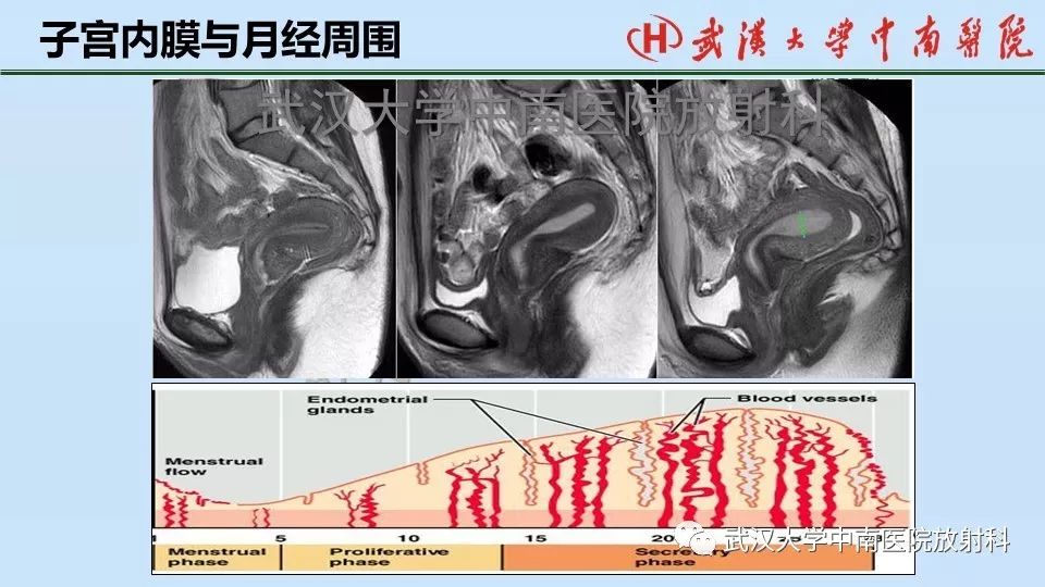 【PPT】女性生殖系统影像解剖及子宫常见疾病
