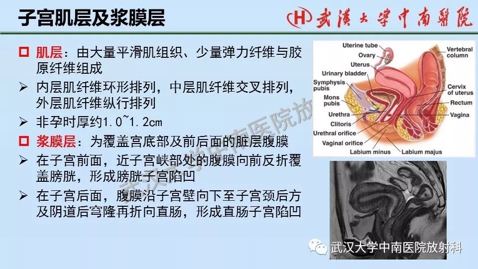 【PPT】女性生殖系统影像解剖及子宫常见疾病